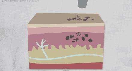 纹身激光去除后可以参军吗,激光去除纹身疤痕可以当兵吗