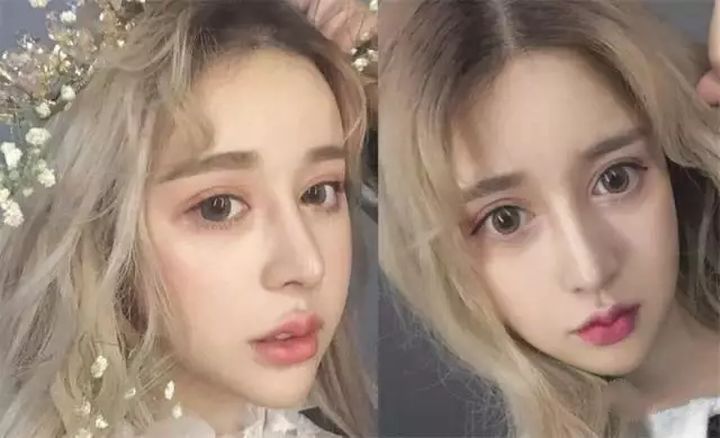 整成网红脸,为什么明星喜欢整成网红脸