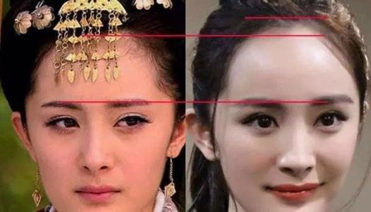 怎么判定发际线后移,如何简单判断发际线后移