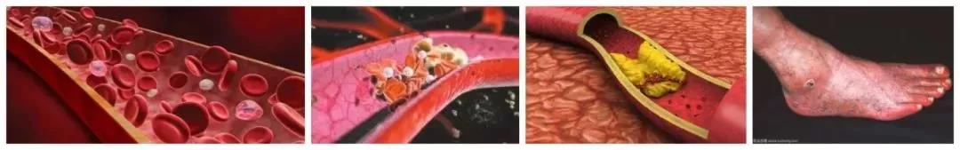 老年人跌倒后髋部疼痛是什么骨折,老人髋部骨折不治后果严重吗