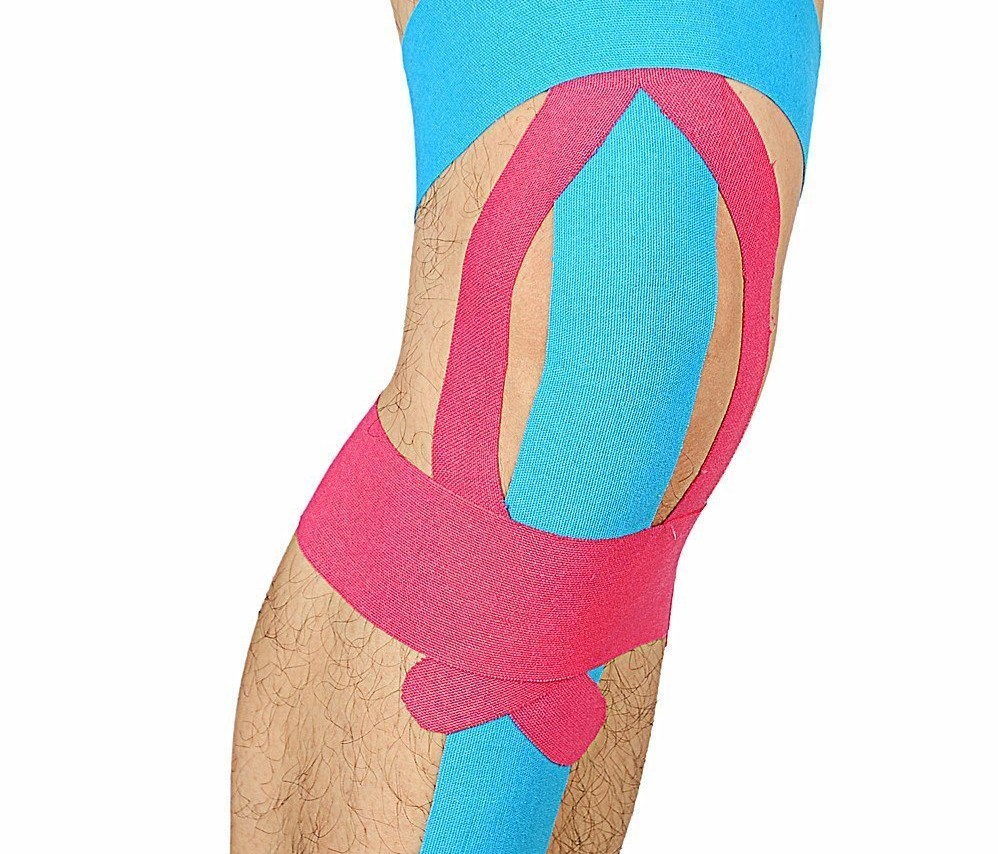 肌内效贴布的应用和原理 (髂胫束综合征怎么使用肌效贴)