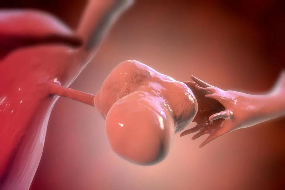 怀孕七周卵巢囊肿9cm可以微创吗,卵巢囊肿会影响胚胎发育吗