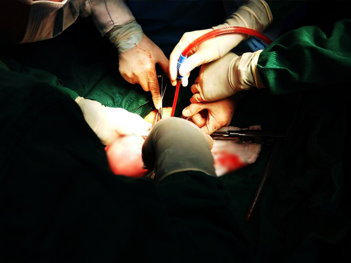 河南孕妇大出血,河南大出血孕妇现在最新进展