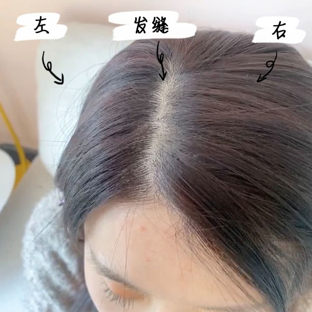 刘海油塌贴头皮怎么办,刘海油头发干枯