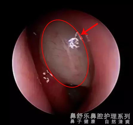 路边的鼻炎馆靠谱吗,路边的鼻炎馆怎么那么贵