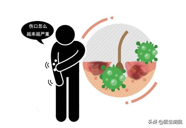 如何判断皮肤有没有感染hpv病毒,感染hpv病毒皮肤的症状是哪些