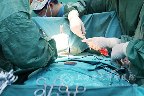 肺癌要怎么分辨早晚期,肺癌早期和晚期怎么判断