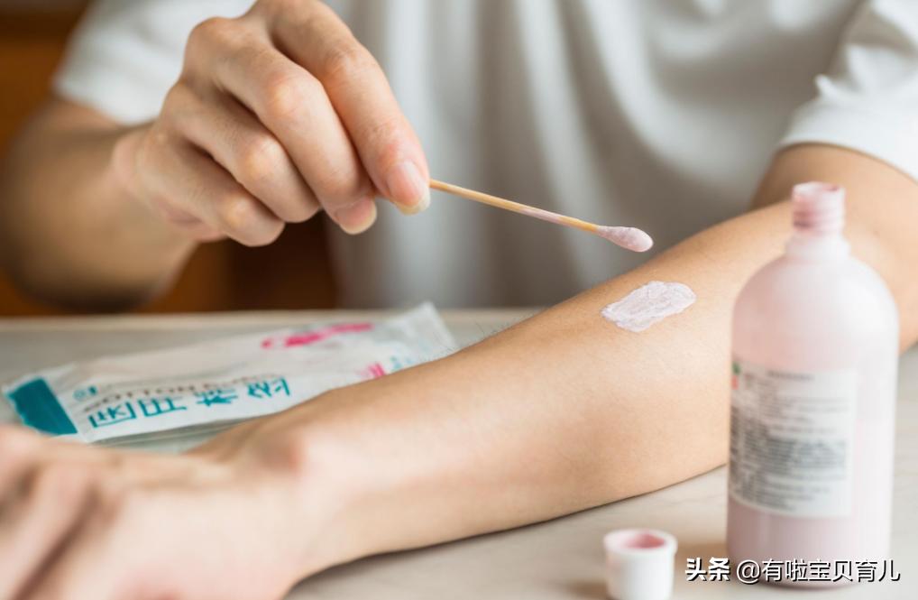 婴幼儿可用的过敏止痒的药膏,婴儿止痒特效药