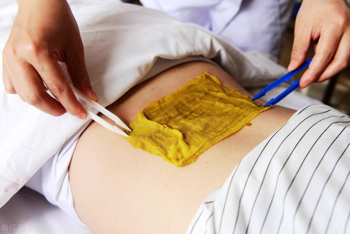 牛皮癣中医扶正祛邪方子,血瘀牛皮癣中医辨证论治