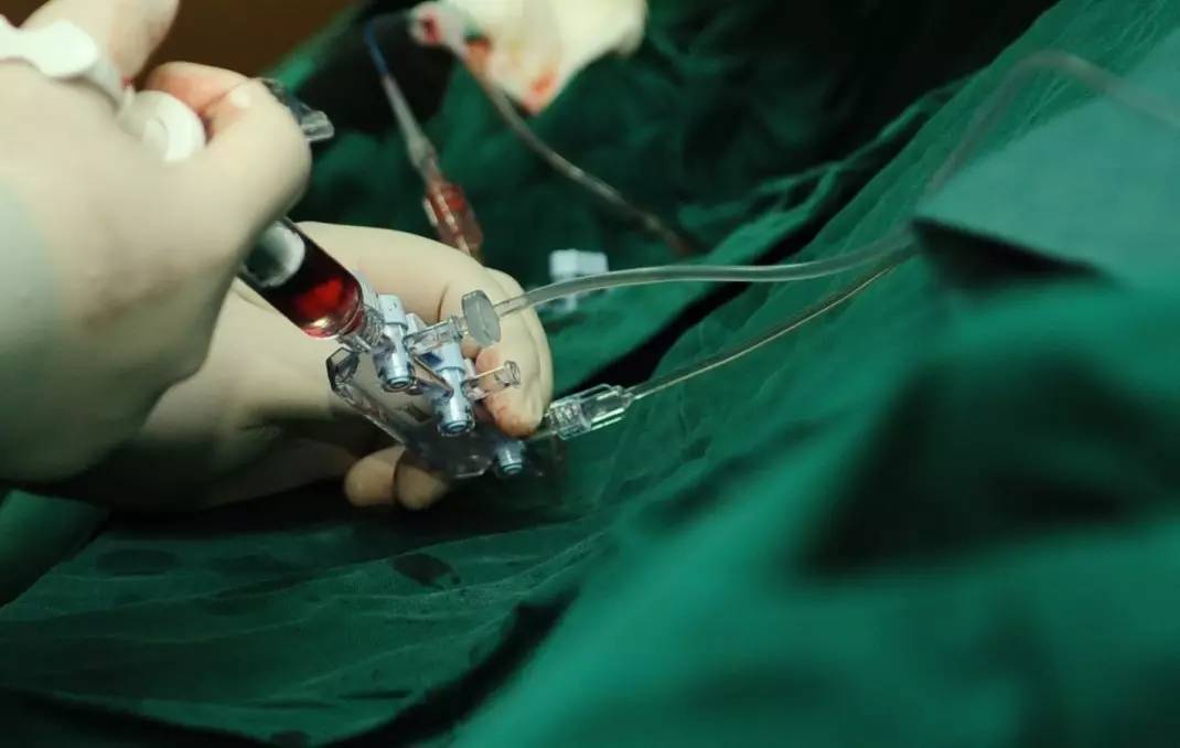 突发心肌梗死记住这5点,心肌梗死不能忽视的8个特别信号