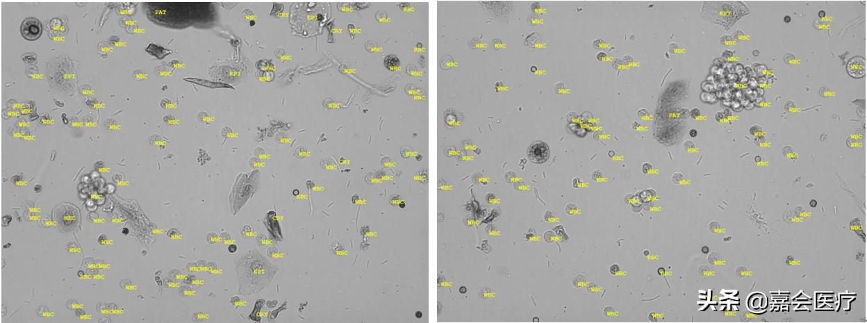 尿液变绿,吃了药尿液变绿是怎么回事