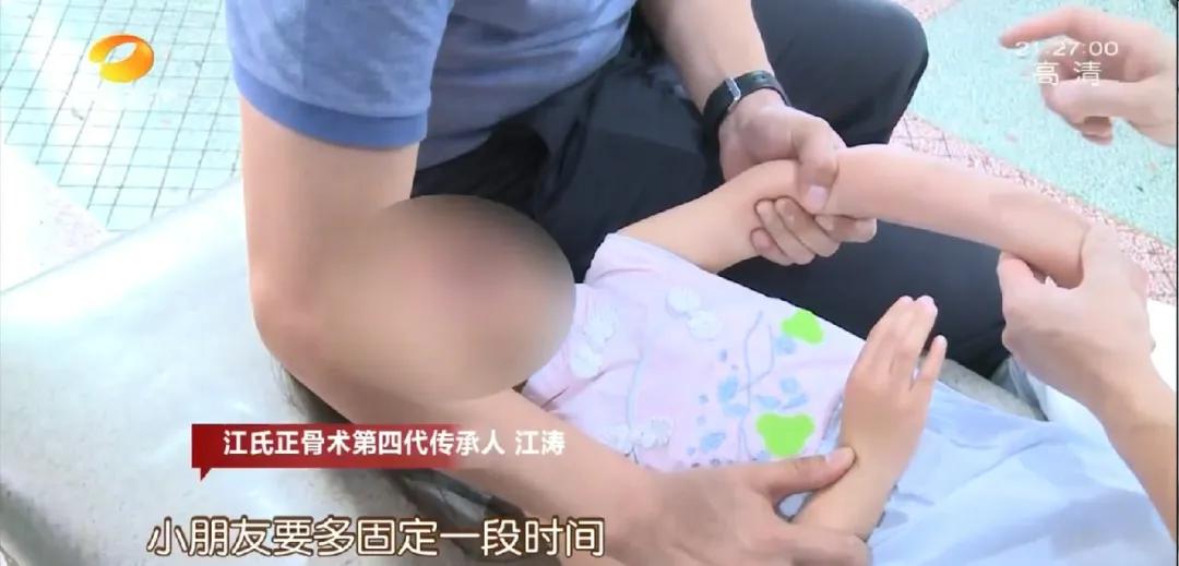 断骨手法复位视频,身怀绝技全集