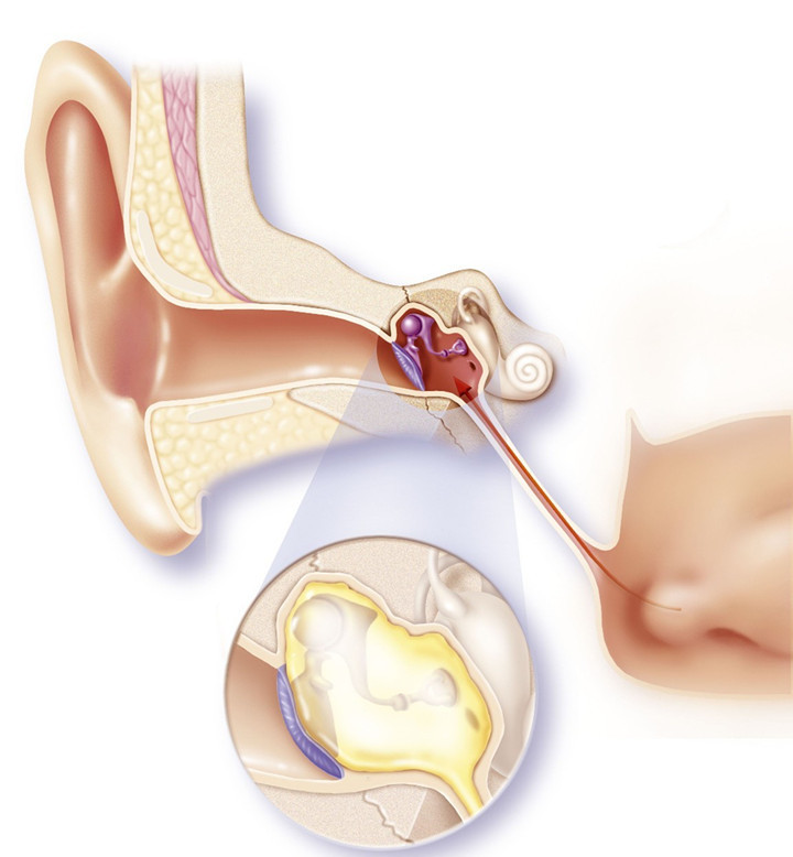 预防中耳炎的十大方法,家长要怎样预防小儿急性中耳炎
