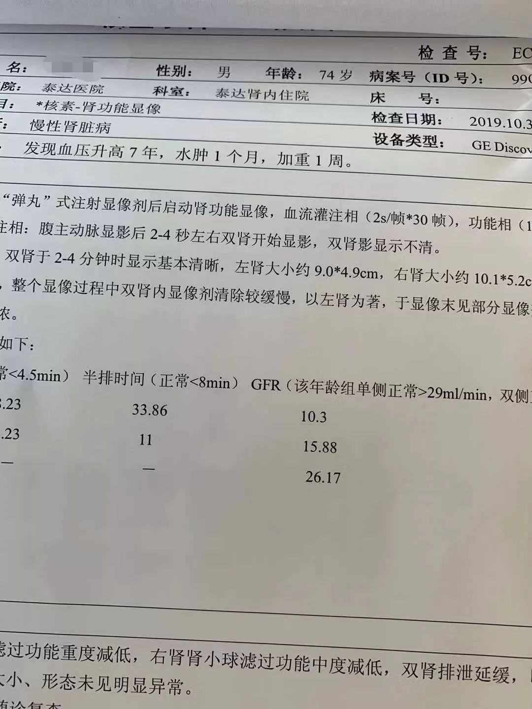 从正常发展到尿毒症要多久,开始肾病到死亡有多长时间