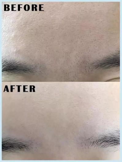 喷雾式的去黑头的东西,去黑头收缩毛孔吸黑头神器测评