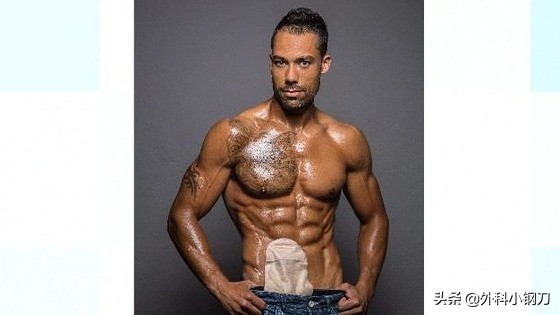 鍖荤敓鍓叉帀澶ц偁,鑲涢棬鍒囬櫎鍚庣画娌荤枟