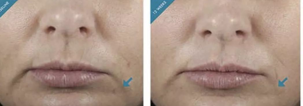 护肤产品成分揭秘,不踩坑护肤的哪些成分不可忽略