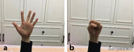 干货！骨折术后患者如何进行居家康复训练？