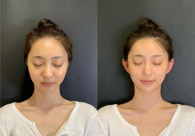 私密整容紧缩手术在中国合法吗,整容医院做私密收紧术要住院吗