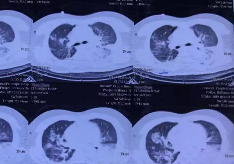 2岁男孩咳嗽厉害是怎么回事,2岁男孩总是咳嗽不断怎么办