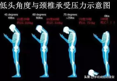 颈后鼓包动作,颈后大包如何处理