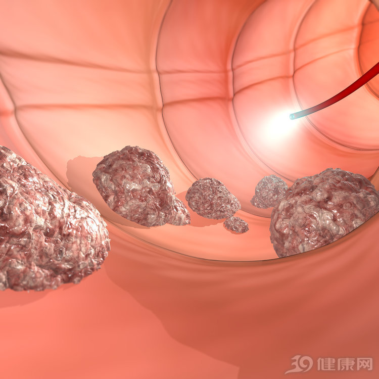 胃肠镜检查怎么减轻痛苦,做肠镜检查怎么可以避免尴尬