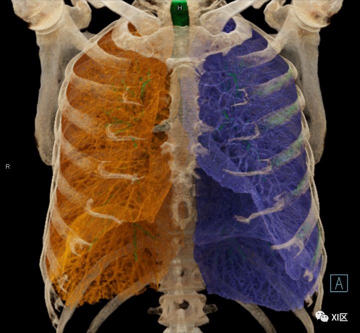 如此详细的肺部影像解剖，有点儿酷！