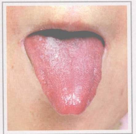 从舌头看身体状况拍照,如何看舌头判断孩子身体状况