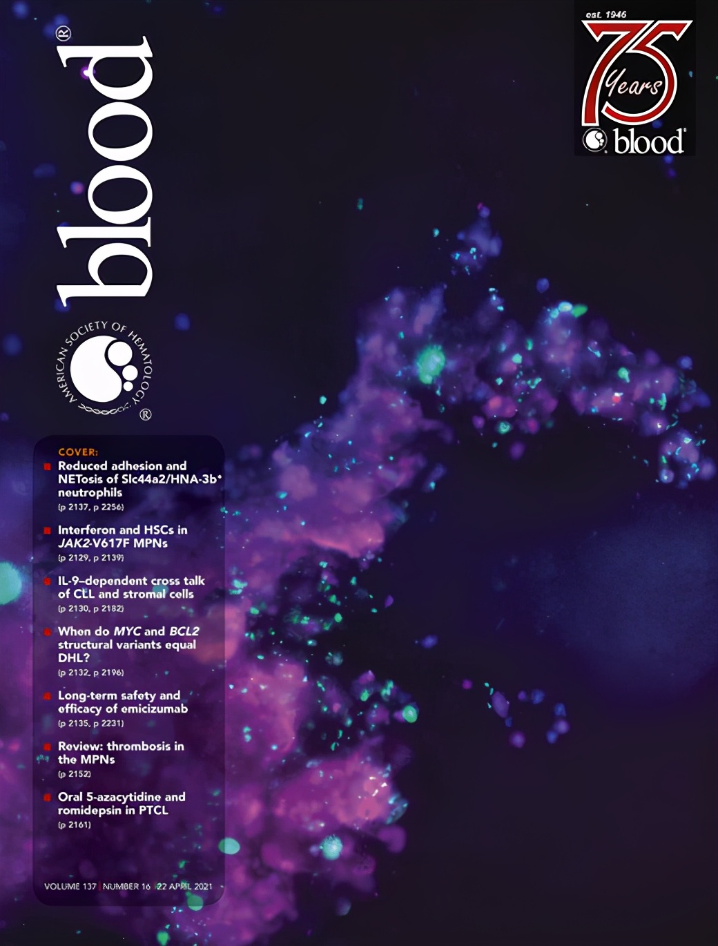 小腿深静脉血栓多久才可以痊愈,深静脉血栓形成的诊断和治疗指南