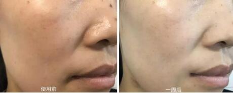 国货护肤品老牌正品面膜抗氧化,清洁面膜推荐去黑头收缩毛孔国货