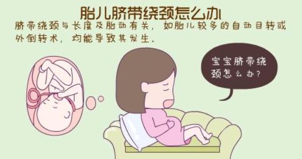 孕期胎儿绕颈？你必须知道这些