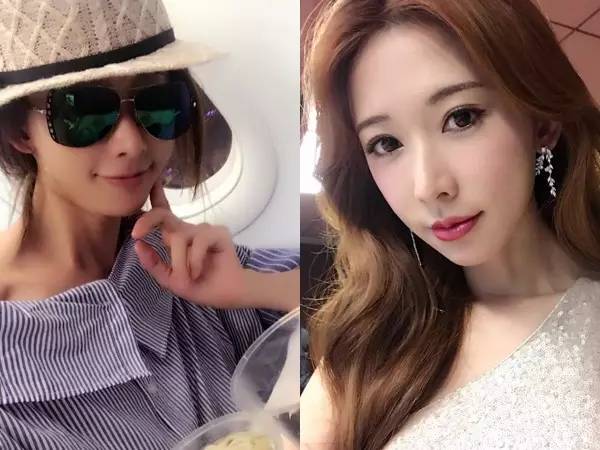 打美白针的明星,女明星打美白针没有副作用