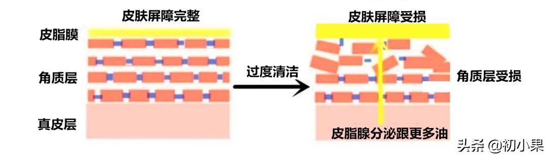 皮肤油是因为缺水吗,皮肤油是不是缺水