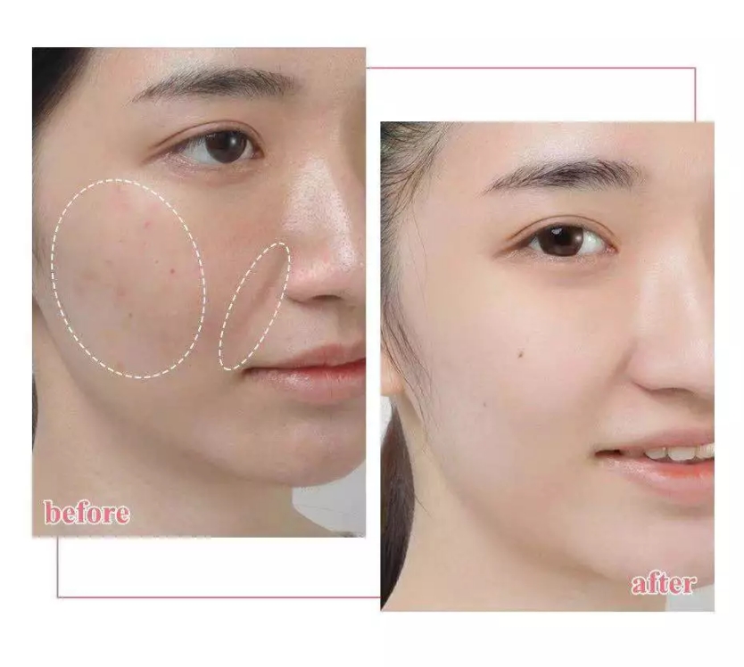 去角质的10个小常识,如何判断要不要去角质呢