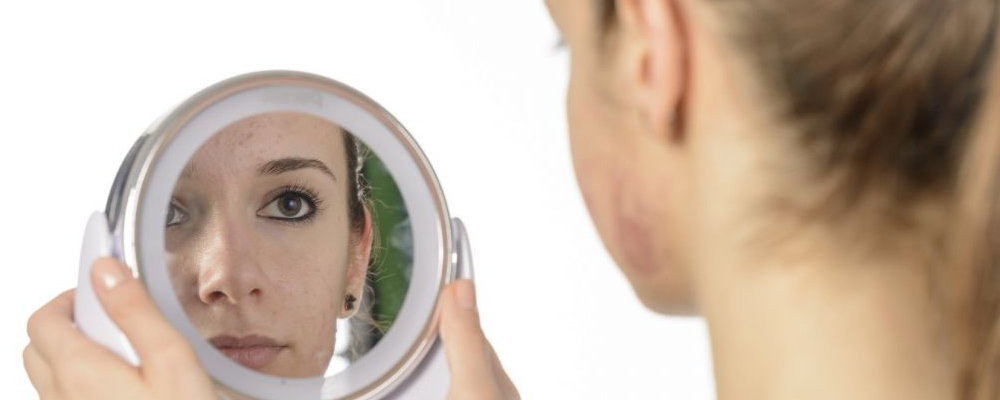 闭口粉刺痘痘皮肤怎么护理,青少年脸上的闭口粉刺怎么治