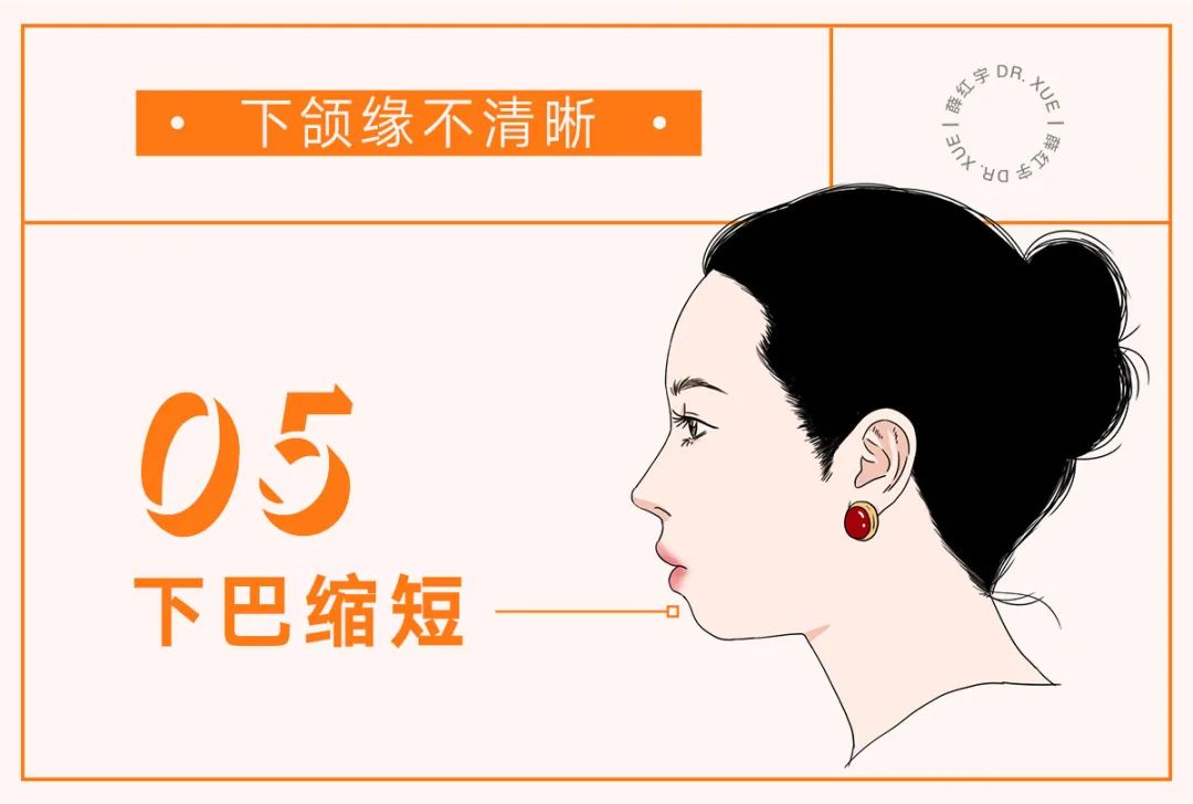 让下颚越来越清晰,下颌缘不清晰的原因
