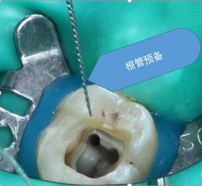 辟谣快速缓解牙疼,辟谣消炎药是抗生素