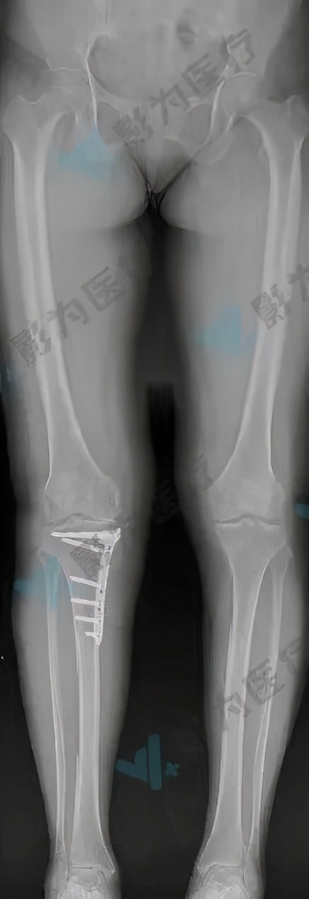 安医大阜阳附属医院减重,阜阳市颍州区安医大附属阜阳医院