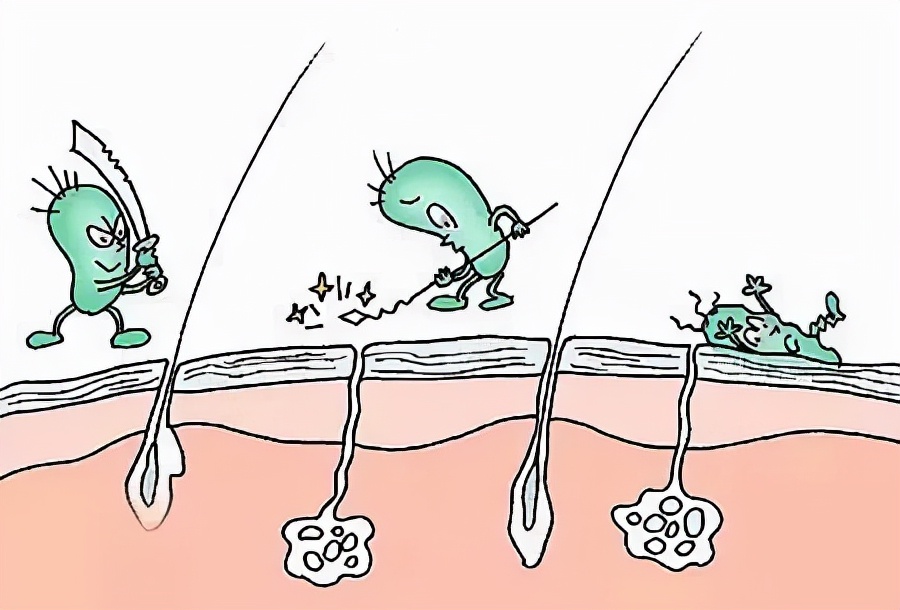 手足癣反复怎么办,手足癣是什么原因导致的