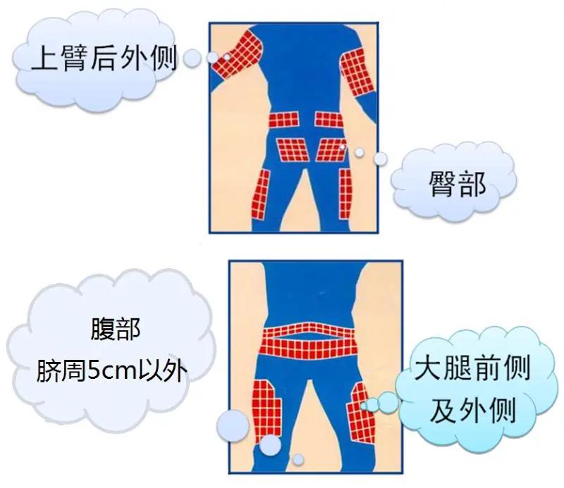 糖尿病引起的皮肤瘙痒药,治糖尿病的胰岛素泵使用方法