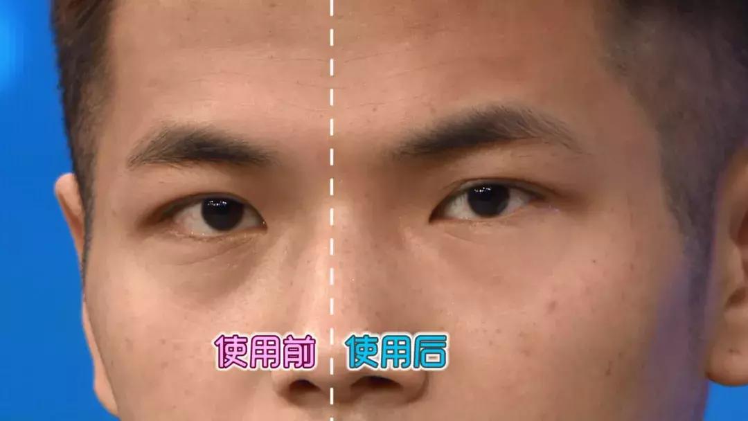 补水保湿淡化黑眼圈眼袋,黑眼袋黑眼圈用什么护肤品消除