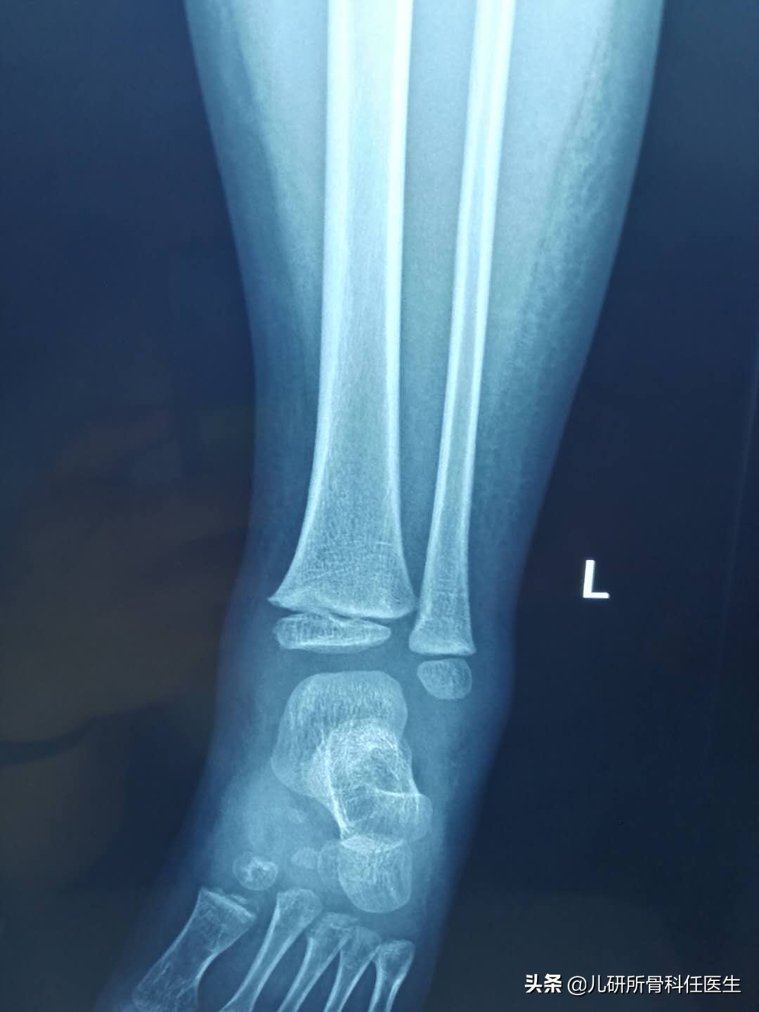 宝宝被蚊虫叮咬了怎么办,宝宝被蚊虫叮咬了用什么药