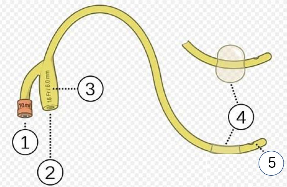 尿管长期留置有必要吗,长期留置导尿管护理