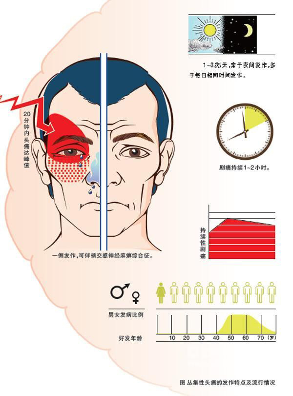 头痛不是简单的问题,头痛不是病痛起来真要命