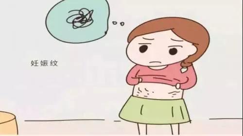 如何识别妊娠纹,怎样识别有没有妊娠纹