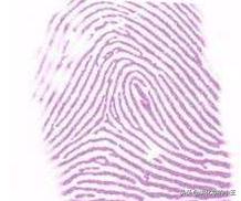 高中化学有机物推断技巧和口诀,化学高中有机物结构判断