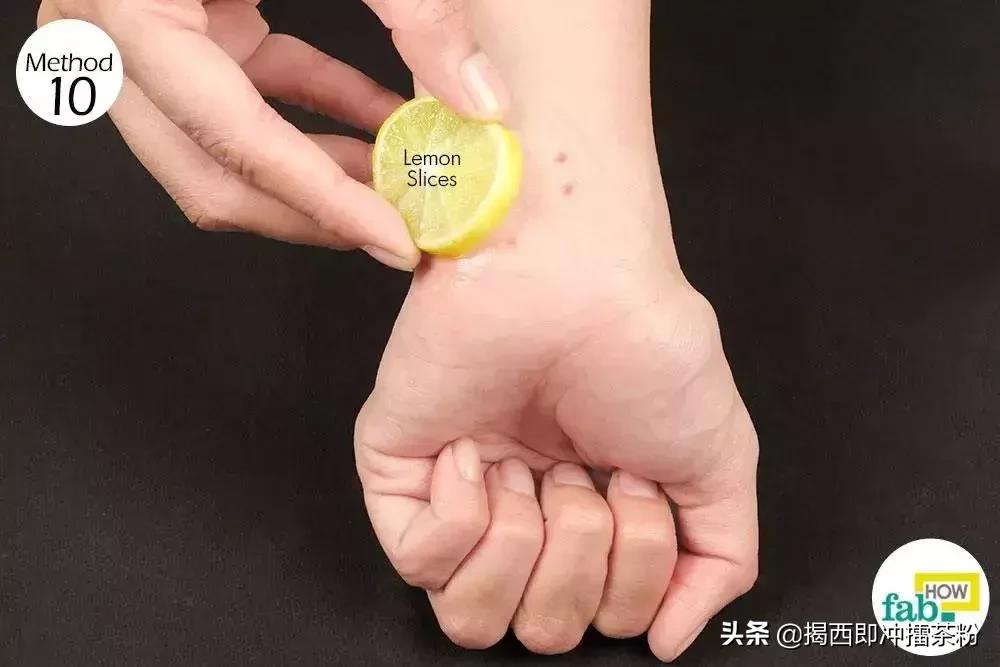 被蚊子咬了但是没有风油精怎么办,被蚊子咬了又没有药怎么办