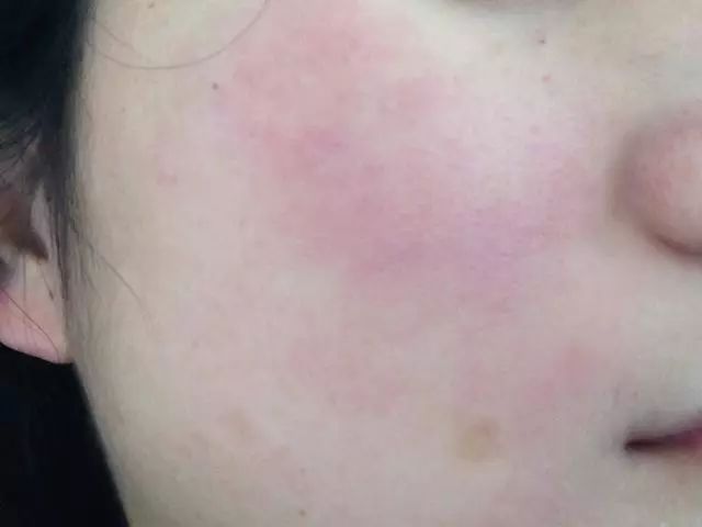 用了好多护肤品脸还是粗糙,化妆棉为什么越来越薄