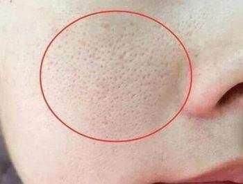 别再乱用清洁面膜了,如何正确洗脸既能白还能长痘