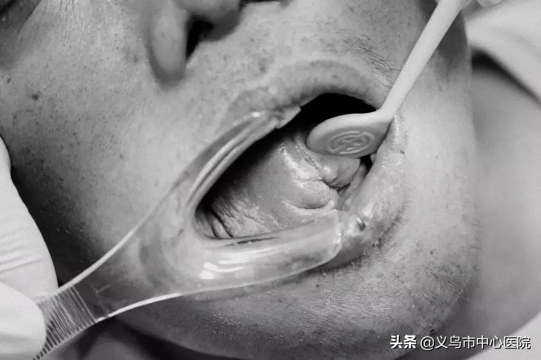 远离舌尖上的致癌物,远离槟榔癌症